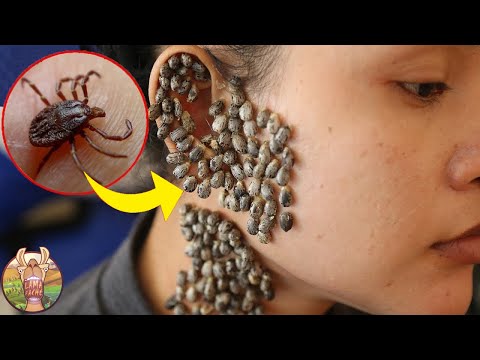 Insectes Les Plus Dangereux Au Monde !