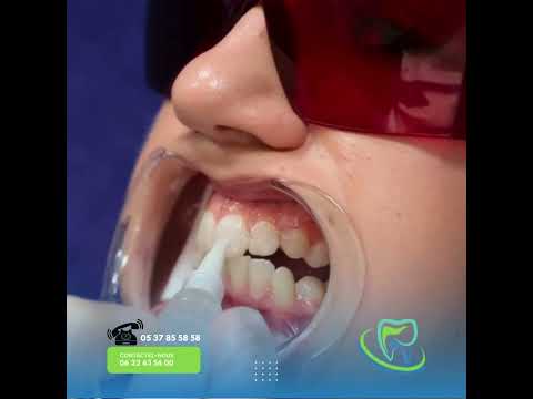 ✨ Rendez à vos Dents leur Éclat Naturel avec nos Astuces de Blanchiment! ✨